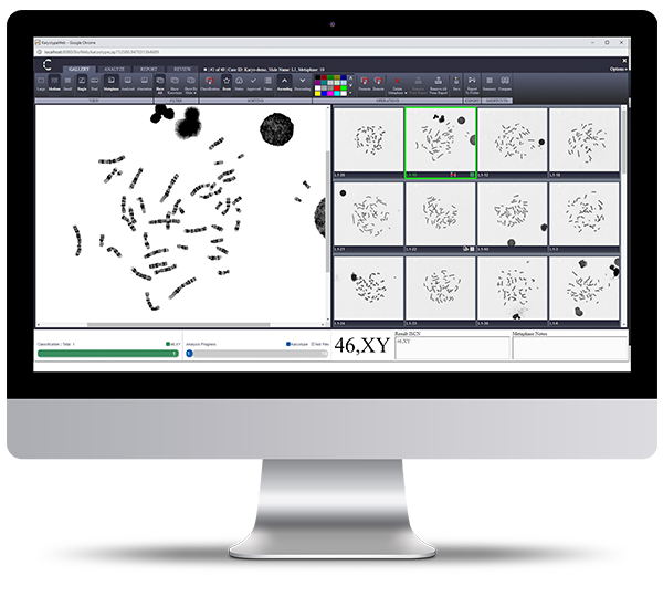 CytoCloud Karyotype application